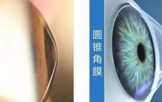 怎么使镜片变薄，怎么使镜片变薄一点