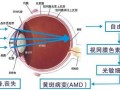 眼睛度数怎么测，眼睛度数怎么测得最准
